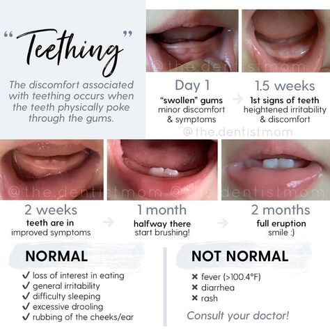 Postpartum Mothershape on Instagram: “DOUBLE TAP & SAVE for later — have you ever wondered how long it takes for your little’s tooth to come in? The 🦷 in this image are Olivia’s…” Teething Signs, Baby Routine, Baby Information, Newborn Baby Tips, Newborn Mom, Parenting Knowledge, Baby Life Hacks, Baby Facts, Baby Teething