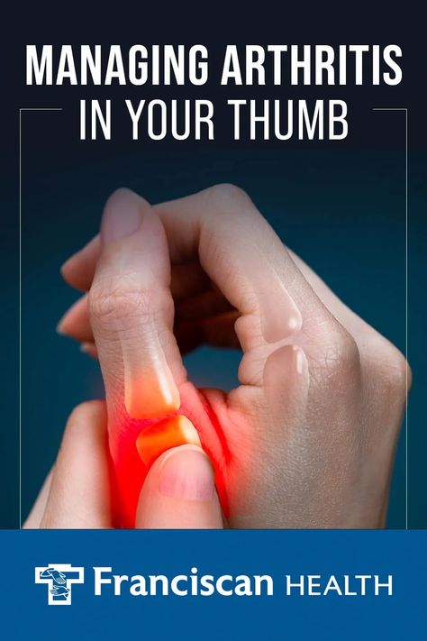 Thumb Pain Relief, Joints Pain Remedy, Arthritic Pain, Knee Pain Relief, Health Screening, Joints Pain Relief, Health Info, Knee Pain, Pain Relief