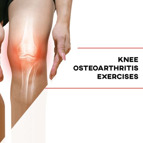 Knee Osteoarthritis Exercises-IG Knee Pain Remedies, Mcl Injury, Knee Workout, Knee Pain Relief Remedies, Osteoporosis Prevention, Bad Knee Workout, Swollen Knee, Knee Strengthening, How To Strengthen Knees