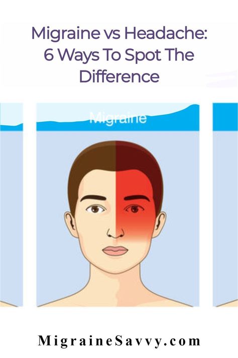 Migraine vs Headache. Learn 6 easy ways to spot the difference so you can treat each one properly @migrainesavvy #migraines #headaches Migraine Vs Headache, Migraine Pressure Points, Migraine Diary, Migraine Piercing, Migraine Art, Migraine Help, Migraine Triggers, Throbbing Headache, Migraine Remedies