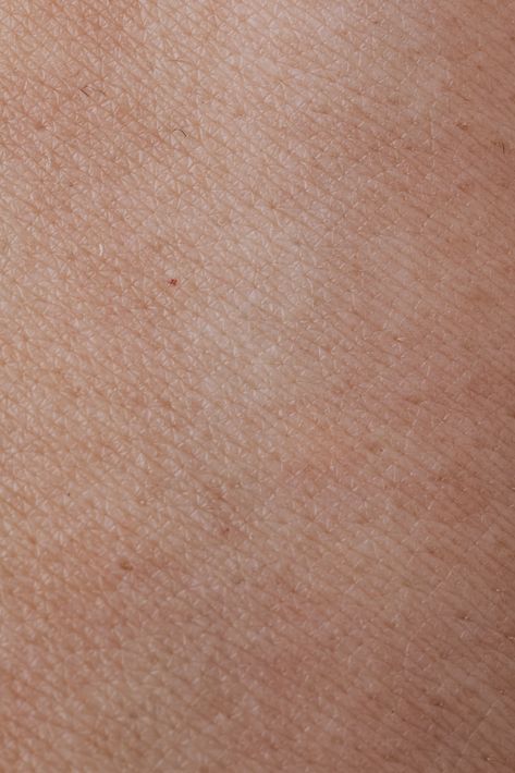 Close-up View Of Human Skin ¡¤ Free Stock Photo, #Human, #View, #Photo, #Skin, #Close Human Skin Texture, Skin Photo, Free Textures, Adobe Photoshop Lightroom, New Images, Beautiful Textures, Reference Images, Close Up Photos, Photoshop Lightroom