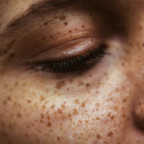 Freckled Back, Male Freckles Aesthetic, Freckles Men Aesthetic, Freckled Aesthetic, Guy Freckles Aesthetic, Tan Skin Freckles Aesthetic, Tan Hands Aesthetic, Brown Eyes And Freckles Aesthetic, Tan Freckled Skin