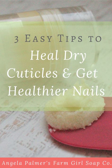 Cute Nails Black, Cuticle Repair, Healthy Cuticles, Nail Growth Tips, Grow Nails Faster, Dry Cuticles, Ways To Heal, Cuticle Cream, Nail Soak