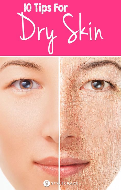 10 Top Tips For Dry Skin: No individual would prefer to keep themselves in a state where the skin is dry and feeling stretchy. So what do you think you can do?Fret not! Here are a few great and natural dry skin care tips that will help you relieve your parched to thus offer you soft, shiny and hydrated skin. #Skin #SkinCare #SkinCareTips Tips For Dry Skin, Dry Skin Diy, Mask For Dry Skin, Extremely Dry Skin, Dry Skin Care Routine, Dry Skin On Face, Skin Images, Dry Skin Remedies, Natural Glowing Skin