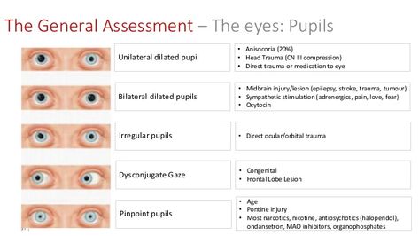 The Paramedic Neurological Assessment Paramedic Tips, Paramedic Science, Paramedic Notes, Medic School, Student Paramedic, Neurology Nursing, Neurological Assessment, Emt Study, Paramedic Student