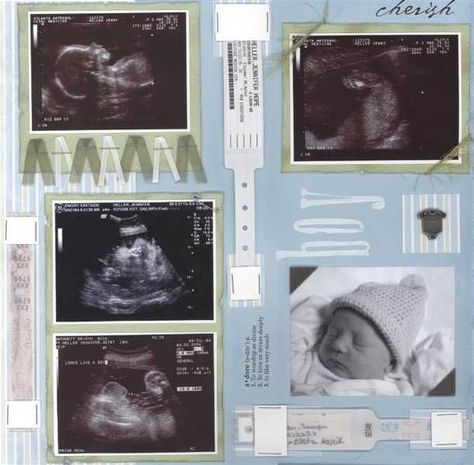 Ultrasound Scrapbook Layouts, Nicu Scrapbook Ideas, Baby Boy Scrapbook Page Ideas, Ultrasound Scrapbook, Baby Scrapbook Ideas, Scrapbook Baby Book Ideas, Baby Boy Scrapbook Layouts, Pregnancy Scrapbook, Scrapbook Bebe