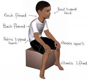 Posture exercise to counteract stereotypical "autistic" posture. Hypermobile Joints, Low Muscle Tone, Pediatric Physical Therapy, Pediatric Occupational Therapy, Posture Exercises, Ehlers Danlos Syndrome, Leg Muscles, Muscle Tone, Occupational Therapy