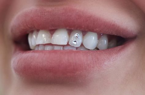 Stone On Teeth, Strass Teeth, Simple Tooth Gems, Tooth Bling, Teeth Jewels, Teeth Gems, Dental Jewelry, Tooth Jewelry, Grillz Teeth