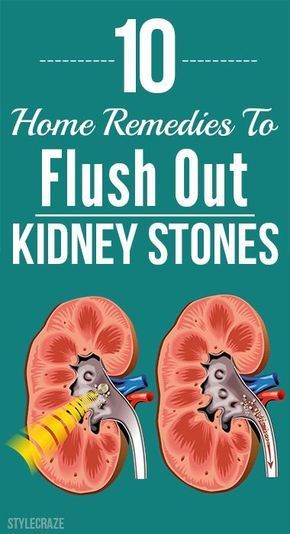 Kidney stones are common condition observed in both men & women. Here are remedies you can try to give a verdict on which kidney stone home remedy worked the best. Home Remedies For Bronchitis, Kidney Stone, Lose 40 Pounds, Healthy Eating Habits, Food Tips, Simple House, Change My Life, Natural Food, Healthy Tips