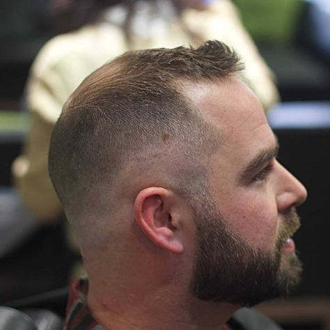 Haircuts for Balding Men #hairstylesformens Bald Haircut, Haircuts For Balding Men, Balding Mens Hairstyles, Cool Mens Haircuts, Bald Spot, Male Pattern Baldness, Pattern Baldness, Bald Hair, Bald Men