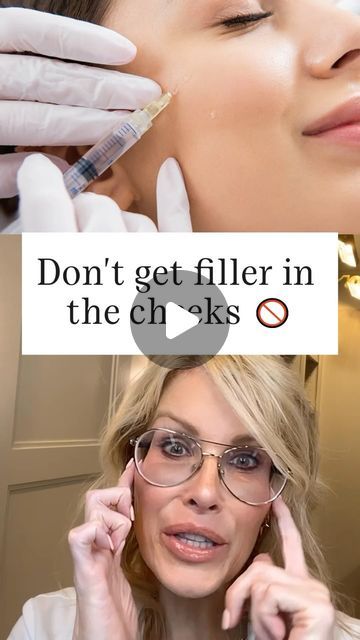 Cheek Fillers Before And After, Cheek Fillers Before And After Face, Cheek Fillers, Lip Injections, Dermal Fillers, Something Else, Nurse Practitioner, Lip Fillers, Med Spa