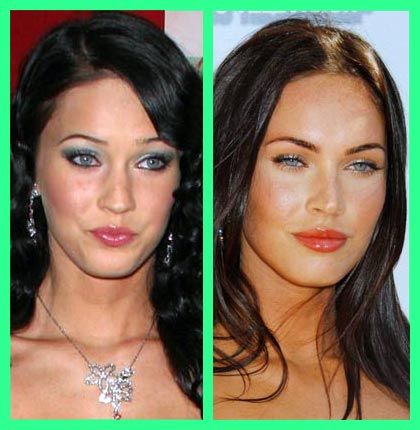 Megan Fox Before and After | Plastic Surgery Before And After Collagen Injections, Celebrity Surgery, Plastic Surgery Fail, Plastic Surgery Photos, Plastic Surgery Gone Wrong, Cheek Fillers, Plastic Surgery Procedures, Before After, Celebrity Plastic Surgery