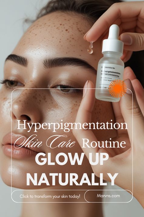 Struggling with uneven skin tone? Discover the ultimate hyperpigmentation skin care routine designed to brighten and even your complexion. Learn how to get rid of hyperpigmentation with targeted hyperpigmentation products and the power of a Hyperpigmentation Serum. Perfect for hyperpigmentation black skin, this routine will help you achieve a radiant, flawless glow. Glow Up Naturally, Hyperpigmentation Products, Hyperpigmentation Black Skin, Hyperpigmentation Serum, Skin Care Hyperpigmentation, Get Rid Of Hyperpigmentation, Uneven Skin, Uneven Skin Tone, Care Routine