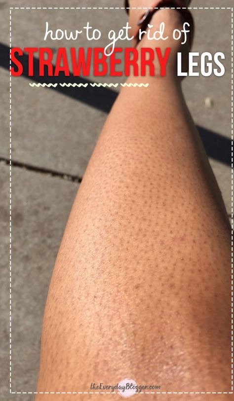 How to Get Rid of Strawberry Legs Coffee Facial, Strawberry Legs, Glowing Radiant Skin, Helpful Advice, Skincare Selfcare, Skincare Secrets, Smooth Legs, Home Remedies For Hair, Luscious Hair