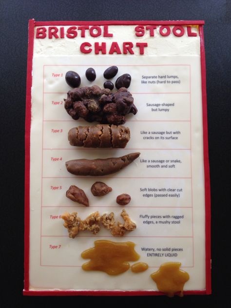 A Bristol Stool Chart cake! There are plans afoot to make this for the leaving do of one of the Consultants. Bristol Stool Chart Cake, Ocd Triggers, Med School Party, 30th Birthday Cakes, Nursing Foods, Lpn School, Medical Sales Rep, Gallery Wall Bathroom, Bristol Stool