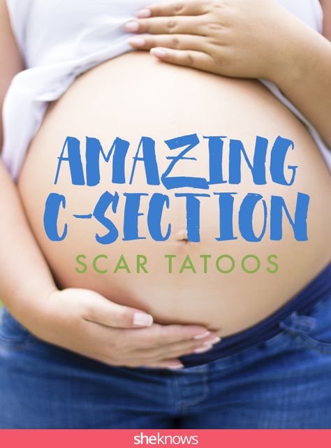 You will never believe what these moms did with their C-section scars Tattoo For C Section Scar, Acl Scar Tattoo Cover Up, C Section Tatoos, Tattoo To Cover C Section, C Section Tattoos For Women, Chest Port Scar Tattoo, Tattoo Over C Section Scar, C Section Scar Tattoo Ideas, Cesarean Tattoo Cover Up