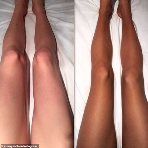 Many have shared their before and after photos - with impressive results... Sunbed Tanning Before And After, Pale To Tan Before And After, Before And After Spray Tan Pictures, How To Stay Tan Year Round, Tanning Drops Before And After, Best Self Tanner Before And After, Melanotan 2 Before And After Tans, Tanned Af Before And After, Tanning Before And After