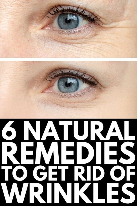 Home Remedies For Wrinkles, Hair Fall Remedy, Get Rid Of Wrinkles, Wrinkle Remedies, Forehead Wrinkles, Under Eye Wrinkles, Fall Makeup Looks, Face Wrinkles, Eye Wrinkle