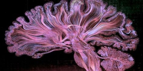 Neuroscientists combined a variety of techniques—drawing, optical engineering, and gold-etching—to create this artistic depiction of the human brain. Neuroscience Art, Science Images, Brain Images, Human Organ, Brain Scan, Brain Art, Microscopes, Medical Art, Human Brain