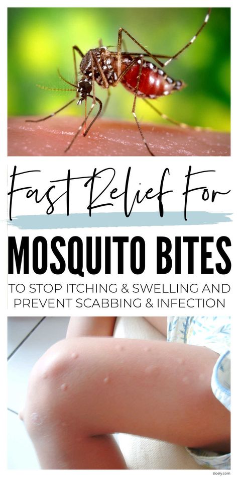 Fast relief for mosquito bites to stop itching, swelling & scabbing with natural ingredients in your kitchen you can use for quick DIY home remedies. #mosquitobite #homeremedies #diyremedy #naturalremedies Mosquito Bites Remedy, Essential Oil For Mosquito Bites Itch Relief, Misquote Itch Relief Diy, Mosquito Bite Remedy Repellent, How To Soothe Mosquito Bites, Diy Itch Relief Insect Bites, Natural Mosquito Bite Relief, How To Stop Itching From Mosquitos, Natural Remedy For Mosquito Bites