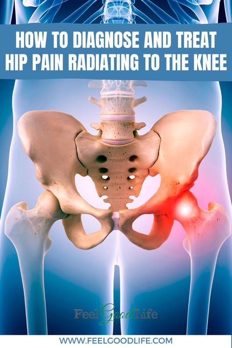 Hip Impingement Exercises, Hip Impingement, Inner Knee Pain, Calf Cramps, Hip Pain Relief, Hip Problems, Reduce Hips, Sciatic Nerve Pain, Knee Pain Relief