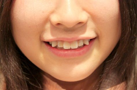 Japan’s Latest Beauty Trend: Paying Money To “Ruin” Your Teeth Cheek Piercings, Black Teeth, Crooked Teeth, Japanese Cosmetics, Photographie Portrait Inspiration, Beauty Standards, Cosmetic Dentistry, Pale Skin, Glass Skin