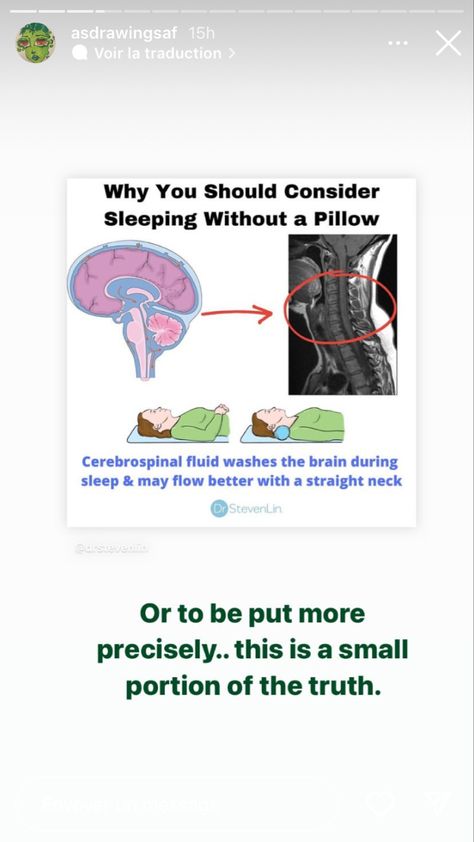 cervical lordosis Cervical Lordosis, Cerebrospinal Fluid, Not Mine, Health, Beauty