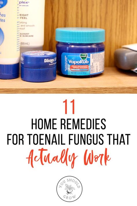 Foot Fungus Remedies, Fungal Infection Remedies, Toenail Fungal Infection, Nail Remedies, Nail Discoloration, Fingernail Fungus, Toenail Fungus Remedies, Nail Infection, Nail Fungus Remedy