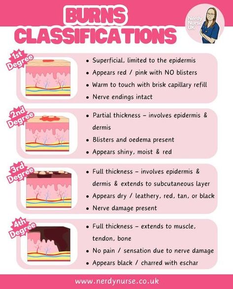 Lauren - Nursing made easy on Instagram: "Do you know the classifications for burns?  #nursingclinicals #pathophysiology #traineenurseassociate #nursingstudentsofinstagram #studentnurses #futurenurses #nursingresources #nurseintraining #nurseinprogress #nursetobe #nursingassociates #traineenursingassociates #traineenursingassociate  #studentparamedicsuk #studynursing #studentnurseuk #studentnurse #nursingnotes #nursingstudent #studentnursesofinstagram #studentparamedic #studentnurse #nerdynurseuk #studentnursenotes" Burn Nursing, Burns Nursing Notes, Burns Nursing Cheat Sheet, Med Surg Nursing Study, Fundamentals Of Nursing Study Guide, Fundamentals Of Nursing Notes, Burns Nursing, Advanced Emt, Rule Of 9 Burns Nursing