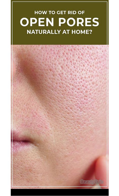 #Skin #Care #Beauty #Face #OpenPores #Naturally #BeautyCare #SkinCare #NaturalCosmetics Minimize Pores Naturally, Face Mask For Pores, How To Reduce Pimples, Face Pores, Pore Mask, Open Pores, Natural Face Skin Care, Skin Care Wrinkles, Glow Skin