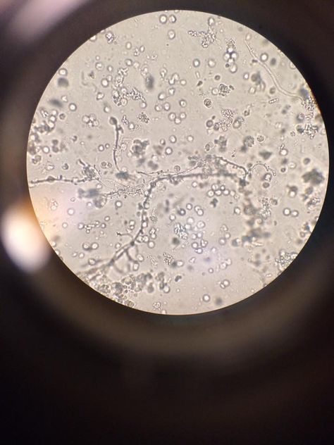 Branching yeast seen in microscopic field/UA Yeast Microscope, Lab Rats, Microscopes, Yeast, Sofia, Skeleton, Lab, Celestial Bodies, Quick Saves