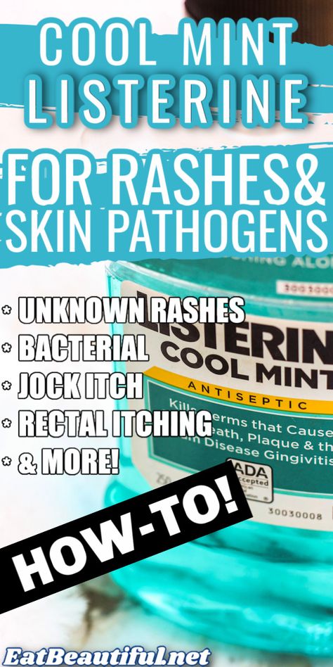 Cool Mint Listerine for Rashes and Skin Pathogens discusses a remedy for irritations ranging from jock itch to unknown itchy rashes anywhere on the body. | Eat Beautiful Health Articles | rash remedy | cool mint listerine | rash | itchy rash | remedy | listerine | jock itch | rectal itching | bacterial | yeast || #rash #remedy #listerine Itchy Rash Remedies, Itching Remedies Skin, Face Rash Remedies, Skin Irritation Remedies, Skin Rash Remedies, Home Remedies For Rashes, Rash Remedies, Itchy Skin Rash, Body Rash