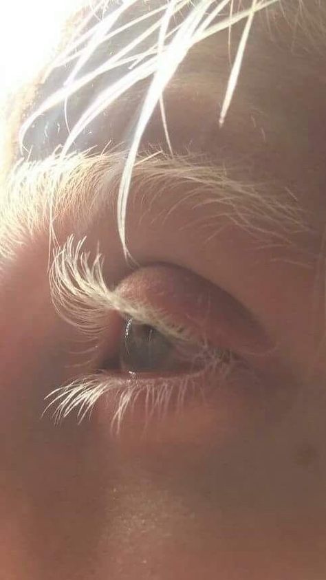 White Eyelashes Aesthetic, White Eyelashes Drawing, Albino Photography, Albino Aesthetic, Albino Eyes, Eyelash Illustration, Eyelash Growth Diy, Albino People, Eyelash Studio