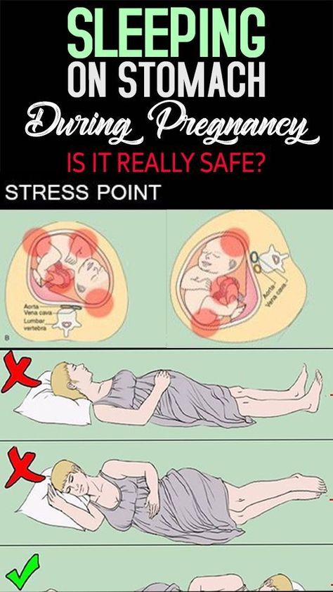 Sleeping positions while pregnant 5 Weeks Pregnant, Pregnancy Info, How To Sleep, Pregnancy Information, Pumping Moms, Baby Sleep Problems, Mom Junction, First Trimester, Pregnancy Care