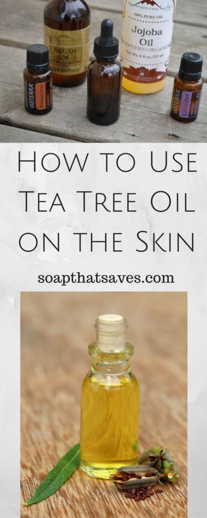 How to Use Tea Tree Oil on the Skin Tee Tree Oil, Natural Mosquito Repellent, Natural Mosquito Repellant, Tea Diy, Oil Uses, Mosquito Repellent, Diy Natural Products, Anti Aging Skin Products, Tree Oil