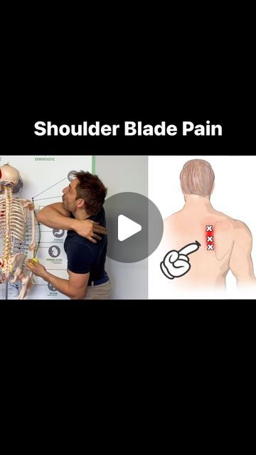 James The Osteopath on Instagram: "Here is how to get rid of shoulder blade pain. #ShoulderBladePain #BackPain #rhomboidpain" Knots In Shoulder Blade, Shoulder Blade Stretches For Pain, Shoulder Blade Pain Relief, Pain Between Shoulder Blades, Shoulder Blade Stretch, Reverse Shoulder Replacement, Shoulder Blade Pain, Shoulder Stretches, Shoulder Knots