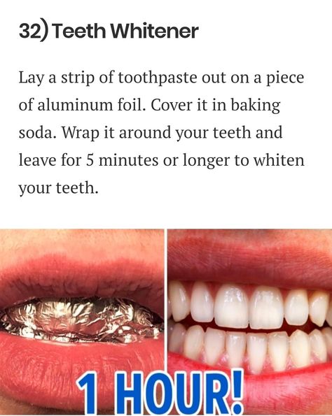 Baking Soda Teeth, Natural Teeth Whitening Diy, Natural Teeth Whitening Remedies, Obličejové Masky, Baking Soda Teeth Whitening, Teeth Whitening Homemade, Teeth Whitener, Teeth Whitening Remedies, Teeth Whitening Diy