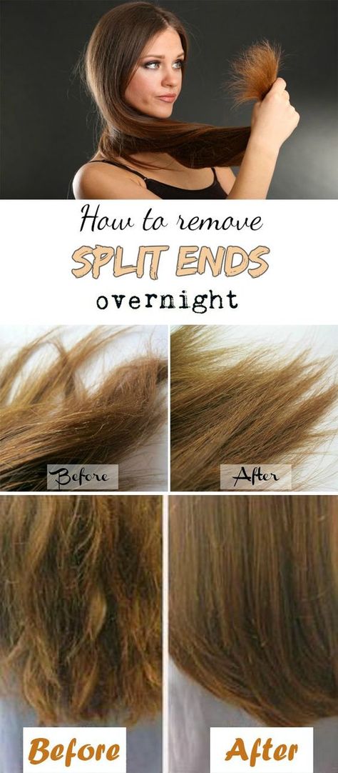 Hair Remedies, Long Hair Girl, Hair Repair, Split Ends, Hair Care Tips, Hair Health, Hair Skin, About Hair, Gorgeous Hair