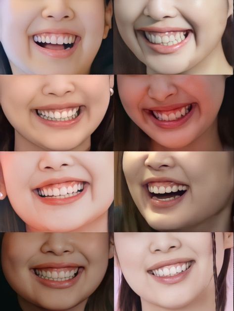 Lisa Gummy Smile, Pink Gums Teeth, Jennie Gummy Smile, Pretty Teeth, Easy Photography Ideas, Gap Teeth, Gummy Smile, Clear Healthy Skin, Smile Teeth