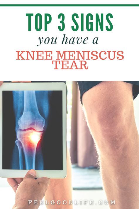 Knee Meniscus, Knee Pain Relief Remedies, Aching Knees, Knee Pain Relief Exercises, Inner Knee Pain, Knee Ligaments, Knee Strengthening Exercises, How To Strengthen Knees, Knee Problem