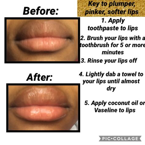 How To Get Plum Lips Naturally, Plum Lips Natural, How To Have Nice Lips, How To Lighten Lips Fast, How To Get Big Lips Naturally, How To Get Bigger Lips Naturally, How To Get Bigger Lips, How To Get Soft Lips, Lighten Lips