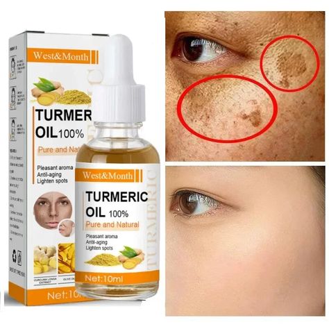 49122793586848 Moisturizing Skin Care, Turmeric Essential Oil, Turmeric Oil, Brown Spots Removal, Dark Spots On Skin, Remove Dark Spots, Skin Care Remedies, Shrink Pores, Skin Care Recipes