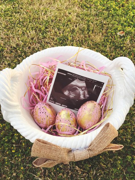 Big Sister Easter Announcement, Easter Sibling Announcement, Easter Birth Announcement, Pregnancy Easter Outfit, Easter Baby Reveal Ideas, Easter Maternity Photoshoot, Bunny Theme Gender Reveal, Easter Baby Gender Reveal, Gender Reveal Ideas Easter