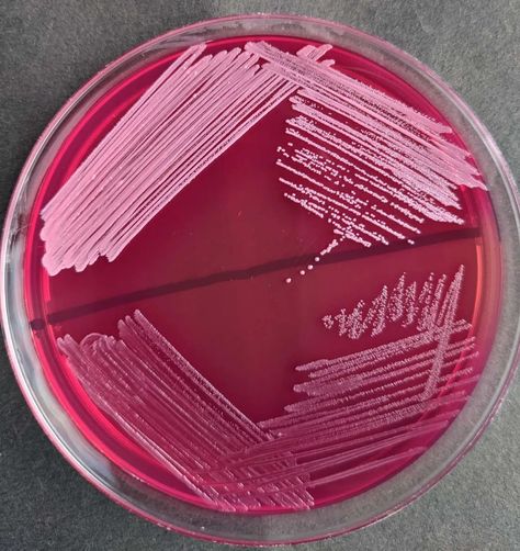 MacConkey Agar: Composition, Uses, Colony Characteristics • Microbe Online Macconkey Agar, Microbiology Lab, Medical Laboratory Science, Culture Media, Laboratory Science, Medical Laboratory, Microbiology, Kirby, Mood Board