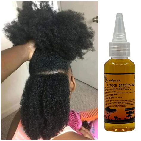 PRICES MAY VARY. Warm Scalp:Heat will allow your hair cuticles to open up and help the oil penetrate your hair shaft. Invigorates & nourishes hair follicles:There is nothing like a good scalp massage, and with Croton gratissimus hot oil , you are going an extra mile to help stimulate scalp. Massaging the oil into your scalp after applying it to your clean hair. Moisturizing:It binds to each strand to help seal and lock the moisture into your hair. ‘’Lightest weight you'll ever put on your hair” African Hair Care, Grow Long Healthy Hair, Natural Hair Growth Remedies, Strengthen Hair Roots, Long Healthy Hair, Hair Roots, Hair Remedies For Growth, Hair Follicles, 4c Hair