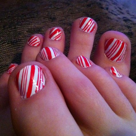 Candy cane toes Christmas Toe Nails, Nail Designs Toenails, Christmas Toes, Holiday Nails Easy, Nails Toes, Candy Cane Nails, Holiday Nails Christmas, Christmas Manicure, Pedicure Designs