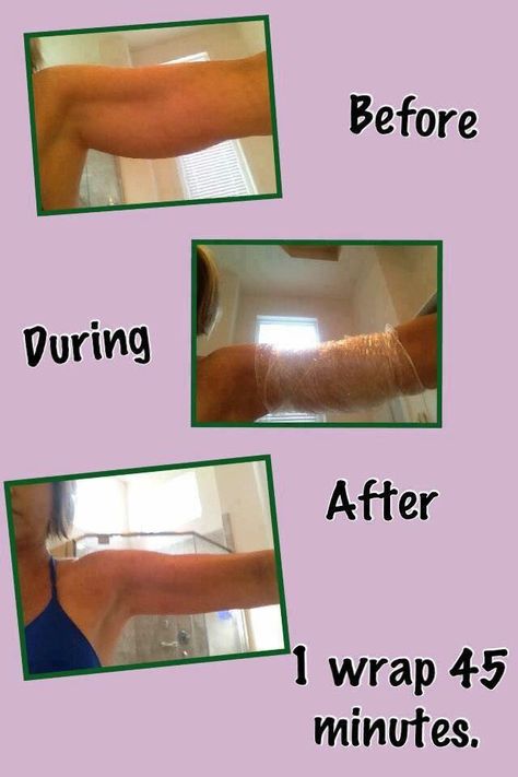 Who needs arm flab!!! Tighten Stomach, Fitness Before And After Pictures, It Works Wraps, Skin Tightening Stomach, Lose Arm Fat, Crazy Wrap Thing, Arm Fat, Loyal Customer, Saggy Skin