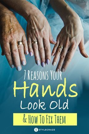 Hand Care Anti Aging, Wrinkles Hands, Natural Skin Care Remedies, Skin Care Wrinkles, Glow Skin, Skin Care Remedies, Look Older, Manicure Y Pedicure, Beauty Skin Care Routine