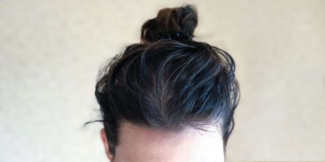 Greasy Hair, Oily Scalp, Greasy Hair Hairstyles, Healthy Hair Tips, Itchy Scalp, Sulfate Free Shampoo, Oily Hair, Diy Beauty Hacks, Beauty Makeup Tips