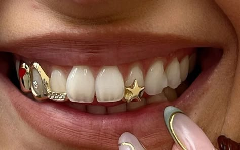 Grills For Women Teeth, Grillz For Women, Tooth Grill, Girl Grillz, Teeth Gems, Aesthetic Clips, Dental Jewelry, Grillz Teeth, Dope Jewelry Accessories